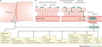 Image result for Candidiasis