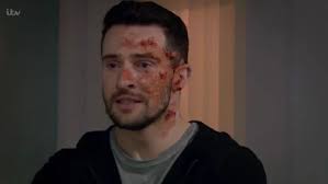 Emmerdale fans in tears as Ross Barton's son fails to recognise him as his  full injuries are revealed