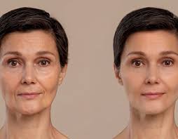 Forehead Progetti :: Photos, videos, logos, illustrations and branding ::  Behance