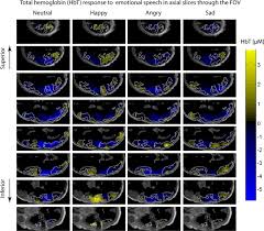 Master all modes in this fun online puzzle game where you must follow the game rules to complete each level. Hemodynamic Responses To Emotional Speech In Two Month Old Infants Imaged Using Diffuse Optical Tomography Scientific Reports