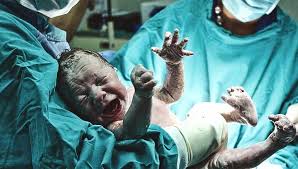 The placenta is a temporary fetal organ that begins developing from the blastocyst shortly after implantation. Low Lying Placenta Placenta Previa