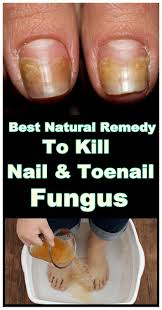 Because Of Humidity And Bacteria Fungal Infections Can Appear Being Very Painful Most Of The Toenail Fungus Remedies Nail Fungus Remedy Foot Fungus Remedies