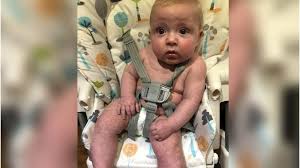 Covid 19 Baby S Mother Issues Mottled Skin Warning Bbc News