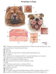 Image result for Pemphigus