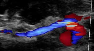 Image result for Pseudoeriosema