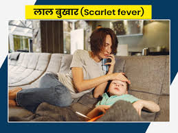 Scarlet fever Symptoms: Know About Causes and Treatment of Red Fever in  Hindi। लाल बुखार होने के लक्षण और कारण। onlymyhealth - Scarlet fever: लाल  बुखार होने पर दिखते हैं ये 9
