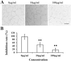 195/2020, ministerul finanțelor publice, împreună cu agenția națională de administrare fiscală. Identification Of Angiogenesis Inhibiting Peptides From Chan Su Sciencedirect