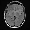 Erste fälle wurden in den usa diagnostiziert. Https Encrypted Tbn0 Gstatic Com Images Q Tbn And9gcq4feufzcofl Vwkho4mwk Zcx Hgga28q5 07j14oyk Lknot Usqp Cau