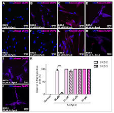 36:05 monkie see 902 просмотра. Cancers Free Full Text Isolation And Characterization Of Two Novel Colorectal Cancer Cell Lines Containing A Subpopulation With Potential Stem Like Properties Treatment Options By Myc Nmyc Inhibition Html