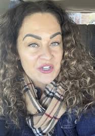 You need an excellent personal injury attorney