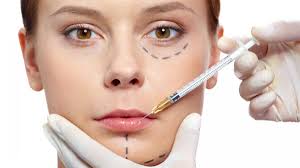 Las técnicas beauty más elegidas: botox y rellenos