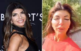 Teresa Giudice Looks Unrecognizable as Doctors Reveal What Plastic Surgery  Caused Shocking New Look