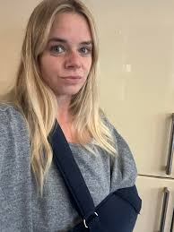 Oops… Managed to break my arm while making a bonfire. Turns out, I'm  definitely too old to be jumping