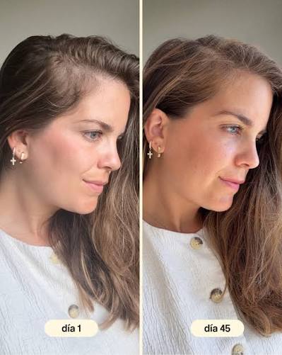 El ANTES/DESPUÉS usando la alternativa natural para la caída capilar que  necesitas ver👀 🫧El Hair Growth & Density Shampoo limpia en profundidad  sin irritar el cuero cabelludo, regula el sebo y activa