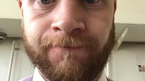 Petition · Mr Medhurst growing back the remainin bits of his hair