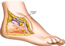 Image result for Calcaneus