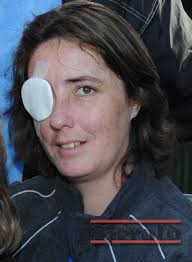 Hammer attack mum shares her story