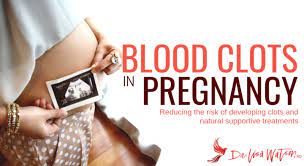 Blood Clots In Pregnancy | Dr. Lisa Watson