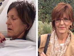 Fundraiser by Andrew Gillfillan : Help Save Our Mom!