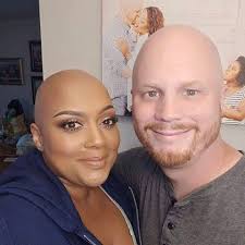 Armani Latimer made a powerful statement at the Dallas Cowboys game by  performing without a wig for the first time, proudly supporting Alopecia  Awareness. Her bravery and confidence are an inspiration to