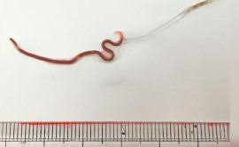 Telur cacing kremi yang tertelan atau terhirup masuk ke tubuh dapat tumbuh hingga menjadi cacing dewasa dan berkembang biak di dalam usus manusia. Cacing 18m Dalam Perut