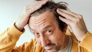 Sexual Side Effects of Minoxidil and How to Manage Them