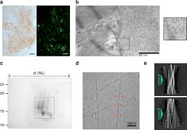 Wipe dalvik/cache, reboot to system (first boot can take some time). Cryo Em Structure Of Cardiac Amyloid Fibrils From An Immunoglobulin Light Chain Al Amyloidosis Patient Nature Communications