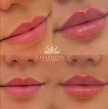 Our commitment to you is to help you look and feel the very best version of yourself. Premier Aesthetic Center Aesthetic Beauty Lounge Highland Park Il