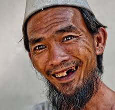 Living in constant fear of your teeth breaking. No Teeth Big Smile Big Smile Just Smile Portrait