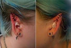 Explore a wide range of the best elf ears on aliexpress to find one that suits you! Fail Thechive Pixie Ears Elf Ears Cosmetic Surgery