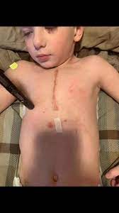 Today I learned my daughter needs a Berlin Heart — a VAD device to help her heart beat until she gets a transplant. It shook me… But it didn't break me. I'll