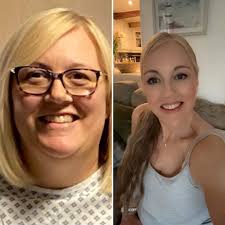 Michelle's Transformation: A Weight Loss Success Story with the Gastric  Sleeve