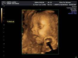 Maybe you would like to learn more about one of these? 4d Ultrasound 30 Weeks 12 Tongue Lauranabs Flickr