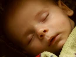 Image result for vyrážka u dětí