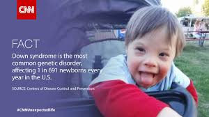 1 in 7 kids has special health care needs. What if one of those kids was  yours? http://cnn.it/1vRutQm via CNN iReport #CNNUnexpectedlife