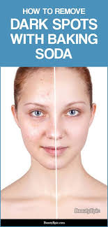 How To Use Baking Soda For Dark Spots Lighten Dark Spots Dark Spots On Skin Dark Spots Under Armpits