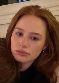 What Does Apple Cider Vinegar And Baking Soda Do For Skin?