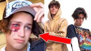 We were uhhhhh, just looking out the window. and the wisdom to know the difference, amen. Lil Huddy Fight With Josh Richards Youtube