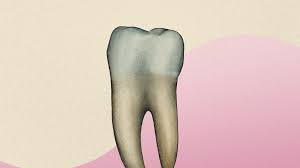 No set time frame can be given. How To Get Rid Of Cavities Without Fillings Is It Possible Self