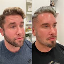 Beverly Hills Aesthetic Medics