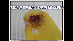 Goz Nezlesi Tedavisi Sonrasi Bakin Ne Oldu Youtube