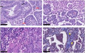 Label the features included in your drawing. Frontiers Ovine Pulmonary Adenocarcinoma A Unique Model To Improve Lung Cancer Research Oncology