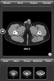 Axial mr high resolution (small fov). Ct Anatomy App Helps Users Learn General Anatomy Using Full Body Ct