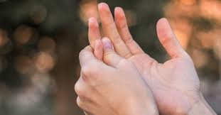 Raynaud S Phenomenon