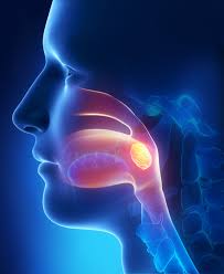 Image result for Tonsillolith