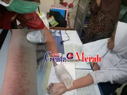 We did not find results for: 31 Gambar Tangan Di Sayat Gani Gambar