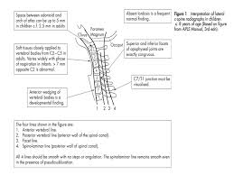 Angle of cervical curvature cervical lordosis the angle should be. Clearing The C Spine Learn Pediatrics