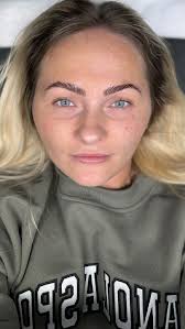 Skin Esteem by Olga Ostapyuk (@skin_esteem__) • Foto e video di Instagram