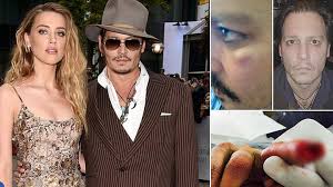 Amber laura heard (born april 22, 1986) is an american film and television actress. Brosalas Skovorodkami Poyavilis Podtverzhdeniya Chto Ember Herd Bila Dzhonni Deppa