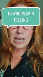 Newborn Skin Peeling: What to Expect After Birth